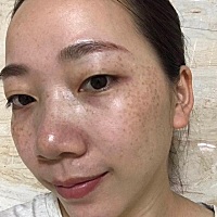 真是一孕毁所有呀，宝妈们有没有跟我一样的经历，看过来，孕期妊娠斑真讨厌，快来一起分享下。