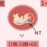 整个孕期，我们会经历8-12次产前检查。而有些产检只有在特定的时间内才准确，NT就是如此，检查的最佳时...