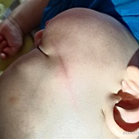 心疼，刚才宝宝扶着床头柜想站起来，还没来得及去抱他就摔下来磕着了，不知道会不会留疤😭😭😭�...