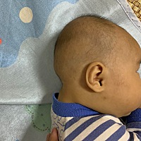 市面上哪种定型枕管用呢？宝宝的头型不圆、后脑勺还 向外凸出、这是为什么呢？
