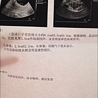 怀孕11周 2天的时候流产，昨天喝了婆婆给我煮的汤后大量出血腹痛不止，到医院检查说流产了？那药婆婆加...