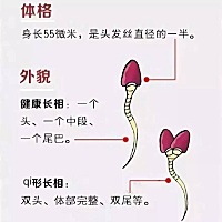 一颗“小蝌蚪”的生命历程   “小蝌蚪”是孕育生命不可少的“宝藏”，但很多人甚至男人自己都并不了解它...