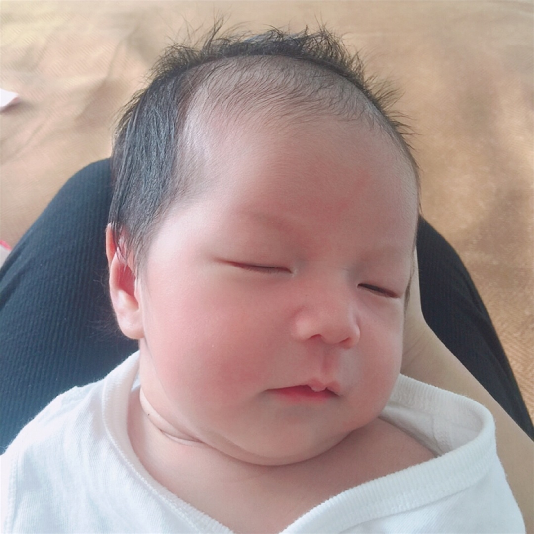出生第10天
