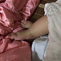 我小孩四个多月，总是喜欢搓脚，两个大脚趾都搓出茧了，想请教大家这是怎么回事呢？