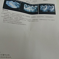 亲们帮我看看，我还有救吗，这是今天的B超单，半个月做三次了，医生也不开药