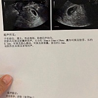 怀二胎了，做个小游戏，大家都来帮我猜猜是男孩还是女孩？