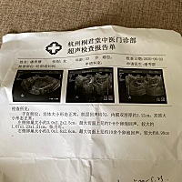 医生说我有一点点多囊。  我应该怎么办 j