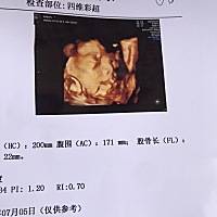 大家看看和之前的四维像不？像妈妈多一点，还是像爸爸？❤️