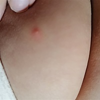 宝宝身上起这种，红点点，怎么办呀