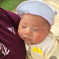 痱子湿疹的药都有，反反复复一直起来满月针都没打，难搞啊
