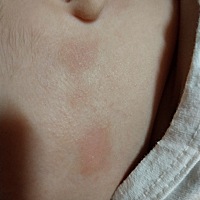 宝妈们帮我看一下，我宝宝脸上这是什么 有两天了，我也不知道什么原因引起的