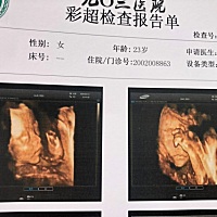 开了两指剖腹产  比想象中好多了  只是克服心里压力  压肚子麻药还没过 感觉不到疼  有镇痛泵72小时  只...