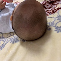 我自己头发少、宝宝头发也少、这样的头发还长得慢、是缺钙吗？