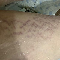 生完20天，上小便就感觉到有东西掉出来了，原来是子宫