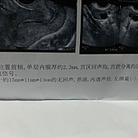 备孕四五个月没怀上大家看看这种多久排卵