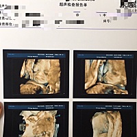 图片依次为，四维照，刚出生，出生6天，个人觉得挺像的
