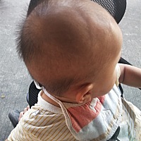为什么六个月的宝宝头像这样，请问正常吗？要去看看吗？