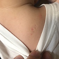 宝宝快6个月大了，这个白色小粒一直都有，不知道对宝宝健康会不会有影响，有人知道吗？