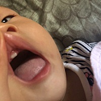 下牙两颗，是不是缺什么呢？AD，DHA，钙镁锌都在吃。