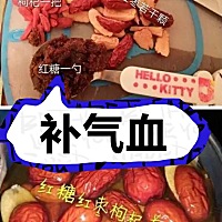 女性平时应多补补气血，补气血的方法有很多种，今天和大家分享几种： 1.红枣8-10个，枸杞一把，红糖一勺...