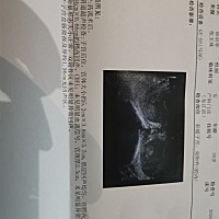 胎停后药流掉了，以下是药流后复查的B 超，是否已经没问题了？