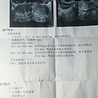 这个是一个月没来大姨妈测的，有懂的吗？我这是什么情况呢？😳
