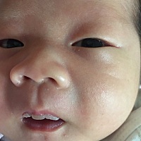 宝宝嘴唇这里白白的，要紧吗？