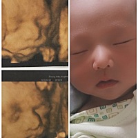 我跟我26周的四维像不？大家觉得我像爸爸还是妈妈呢？还是长的像哥哥