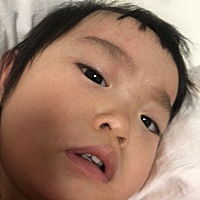 最近给宝宝换了奶粉 宝宝脸上有身上没有 不知道是因为空气潮湿还是奶粉过敏或者是太热了 请大家帮忙看看