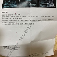 一胎就发上来看了，超级准，姐妹们说的都对，二胎还想让姐妹们帮忙看看，太好奇了，男女都好，谢谢谢谢～