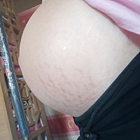 小坏蛋在肚子里折腾你妈，出来也折腾你妈。你看，你妈为了你付出多大，妊娠纹啊