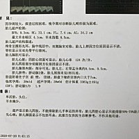 说一下整个孕期的症状吧！孕吐三个月，16周左右明显胎动了（一胎妈妈），像小鱼吐泡泡一样，整个孕期都...