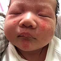 15天开始长的，一下子长了好多