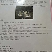 求教看下男孩还是女孩