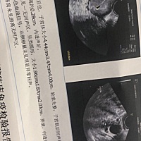 原来很期待的生活，没有胎芽没有胎心，很无奈，清宫了，医生又说子宫收缩不好，我感觉我自己都开始神经...