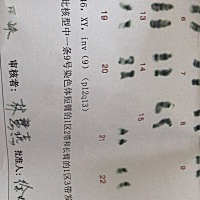 老公9号染色体倒位，哪里做试管呢