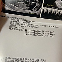 大家看看这是男宝女宝