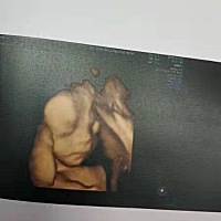 好快啊，感觉孕期天天登入现在生了都没来过。宝宝都九个多月了，孕期跟产后真的恍如隔世，太快了，时光...