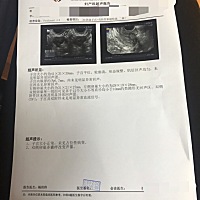 25岁，从未有过怀孕经历，第一次备孕，因为多囊近两斤还没有结果😭老公精子，我的血糖，白带，造影检...