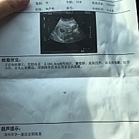 六月一号来的大姨妈来了三天就没了，到月底三十号左右试孕纸两条杠，现在八月十六了，中间断去检查了三...