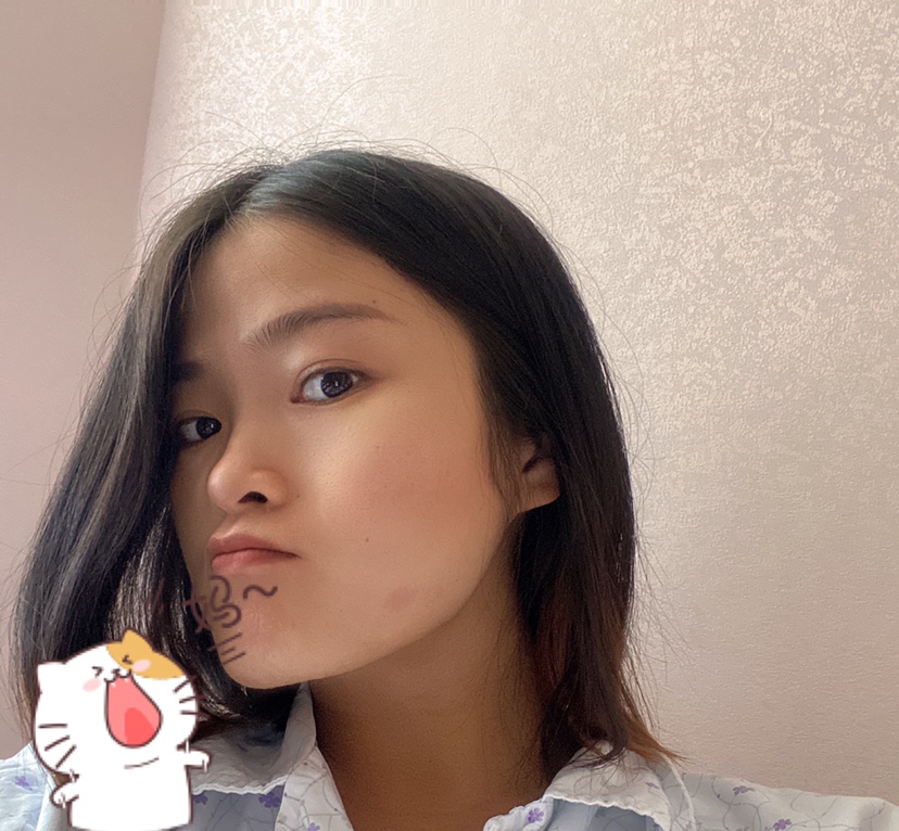生完长了一个大包😂