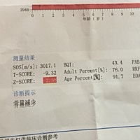 宝贝八个月去做儿保，身高66.7，体重16.2斤，医生说身高偏矮，体重正常，开了骨密度的检查，结果骨密度...