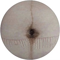 生孩子后总觉得肚子很丑 现在好像淡了好多呀