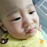 是妈妈没有看好你  你自己拿着小被子  盖了头上 玩  还走着  我以为没事  再床上  结果一晃神  你就嗑了...