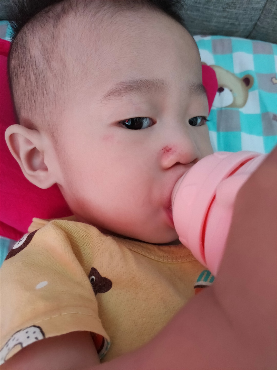 早上起来就成了这样