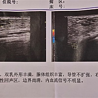 可不可以教我怎么揉散硬块，已经乳腺炎了，医生让尽快揉散否则化脓要开刀的。 可我不会揉，吊了两天消炎...