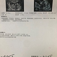 NT能看出男女吗？很好奇