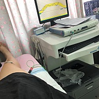 今天是最后一次修复啦！😊￼￼￼终于做完了 修复做了我心里也放心了￼￼哈哈😊之前产后48天去￼检查...