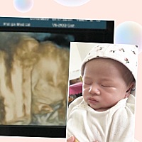 大名黄亦甜，小名甜甜，甜妹。亮个相😬 四维还是很像的。😬 出生13了的甜妞妞。 出生13了的甜妞妞。