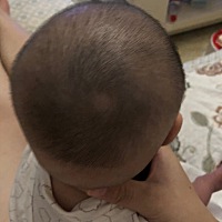 ☺️  月子里左右侧睡 出月子平睡的头型可还行